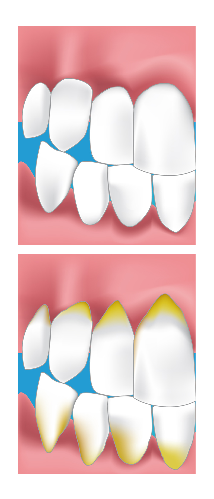 parodontiste la defense courbevoie